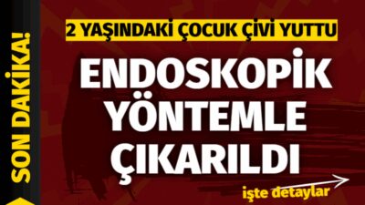 Süleyman Demirel Üniversitesi Hastanesi’nde gerçekleştirilen başarılı endoskopik işlemle 2 yaşındaki